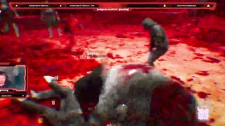 Time get my zombie bite rage on dead island 2